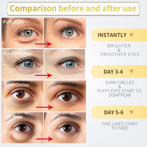 24K Gold Under Eye Patches - 60 Pack for Puffy Eyes, Dark Circles, Bags & Wrinkles with Collagen & Hyaluronic Acid - Image 6